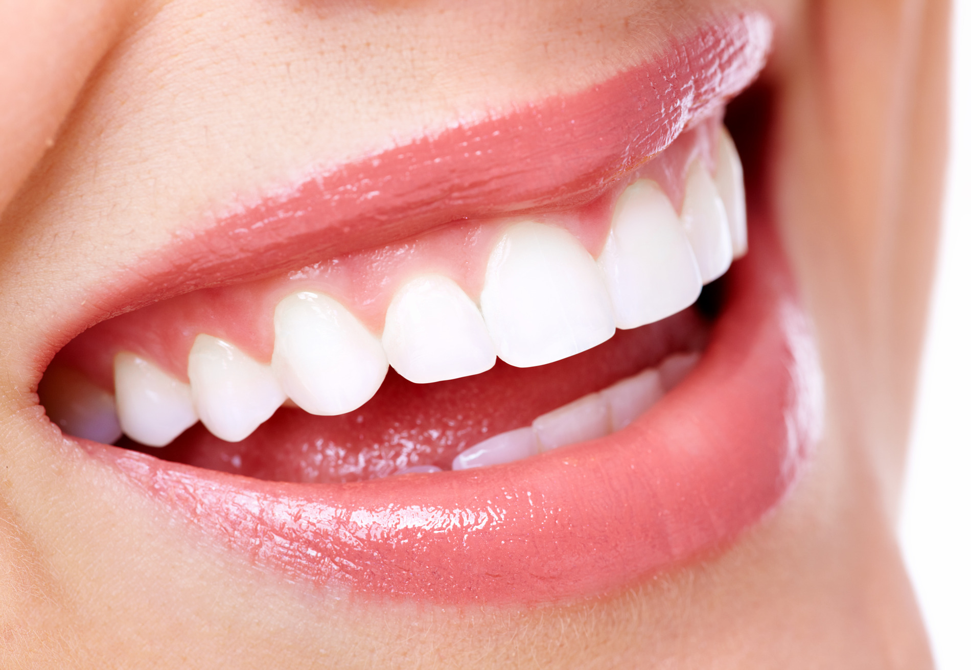 Woman smiling after dental extractions in Seminole, FL